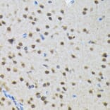 Immunohistochemistry - Anti-SMN/Gemin 1 Antibody [ARC1710] (A308623) - Antibodies.com