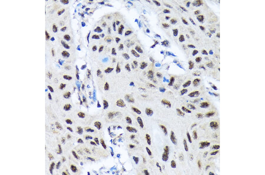 Immunohistochemistry - Anti-SMN/Gemin 1 Antibody [ARC1710] (A308623) - Antibodies.com