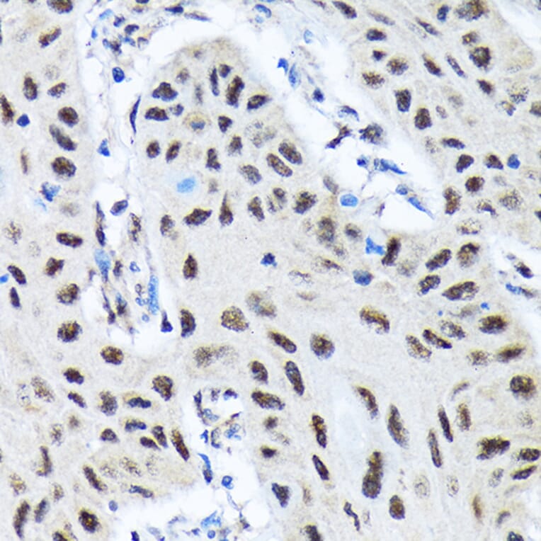Immunohistochemistry - Anti-SMN/Gemin 1 Antibody [ARC1710] (A308623) - Antibodies.com