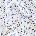 Immunohistochemistry - Anti-SMN/Gemin 1 Antibody [ARC1710] (A308623) - Antibodies.com