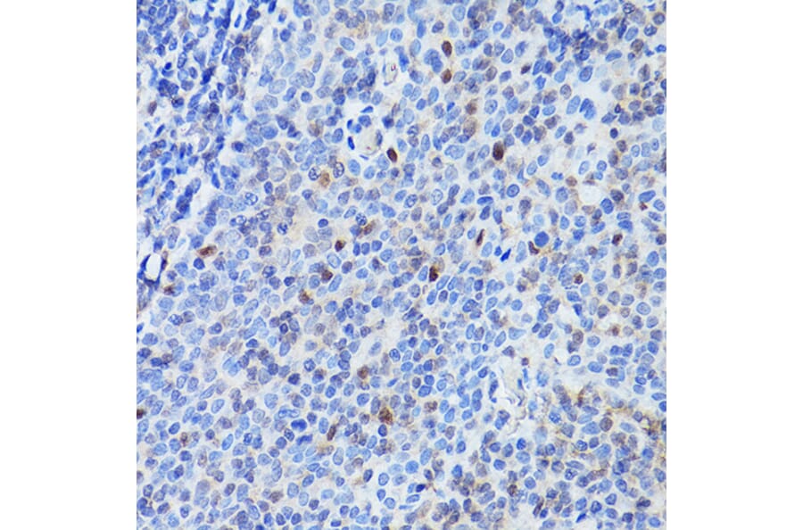 Immunohistochemistry - Anti-PU.1/Spi1 Antibody (A308624) - Antibodies.com