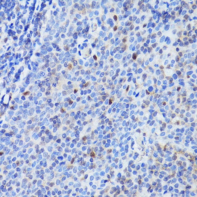 Immunohistochemistry - Anti-PU.1/Spi1 Antibody (A308624) - Antibodies.com