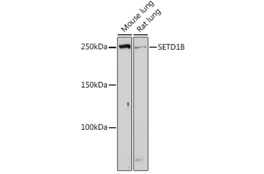 Western Blot - Anti-SETD1B Antibody (A308625) - Antibodies.com