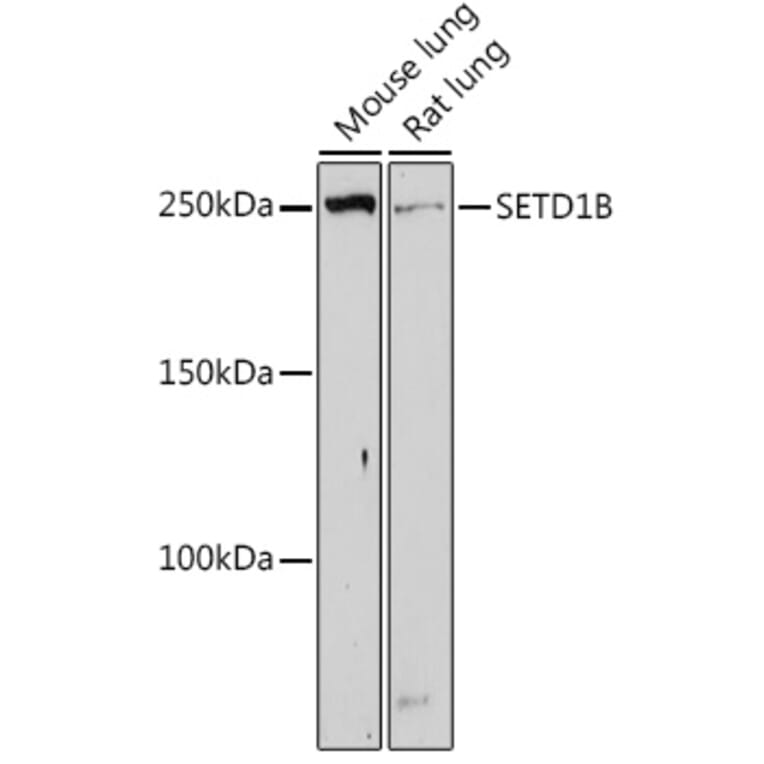 Western Blot - Anti-SETD1B Antibody (A308625) - Antibodies.com