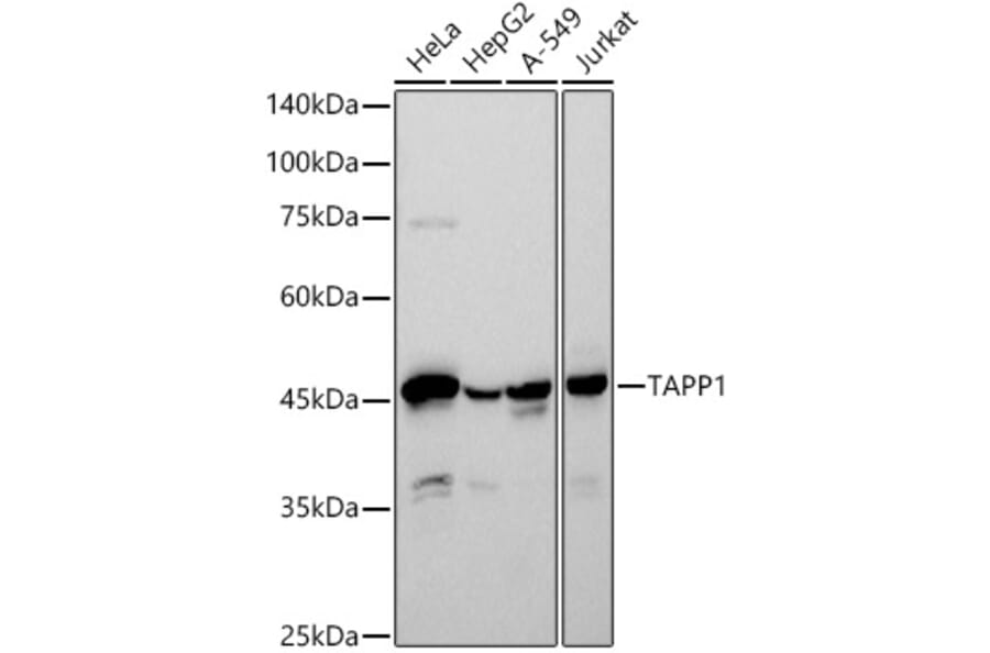 Western Blot - Anti-TAPP-1 Antibody [ARC2927] (A308627) - Antibodies.com