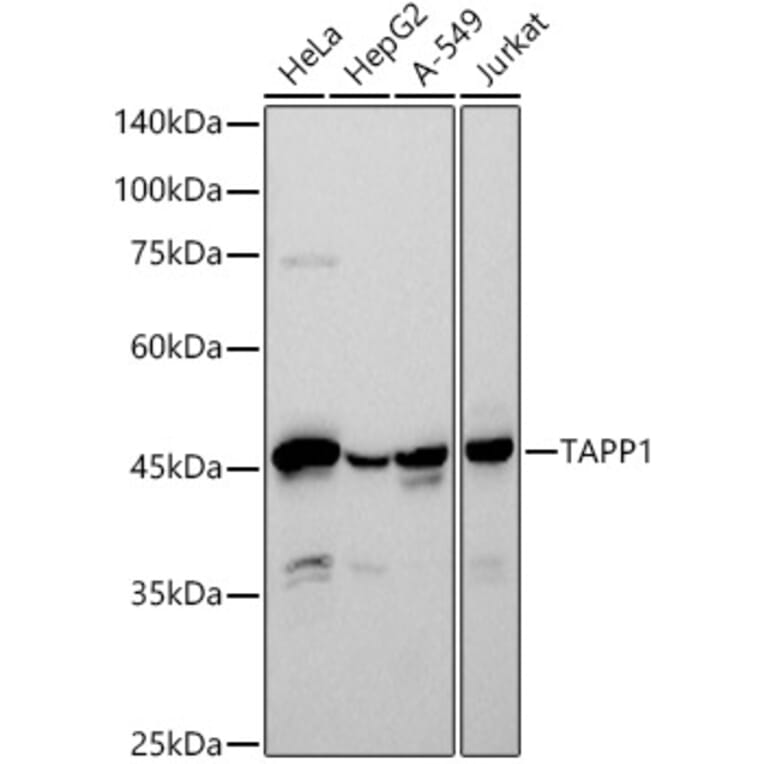 Western Blot - Anti-TAPP-1 Antibody [ARC2927] (A308627) - Antibodies.com