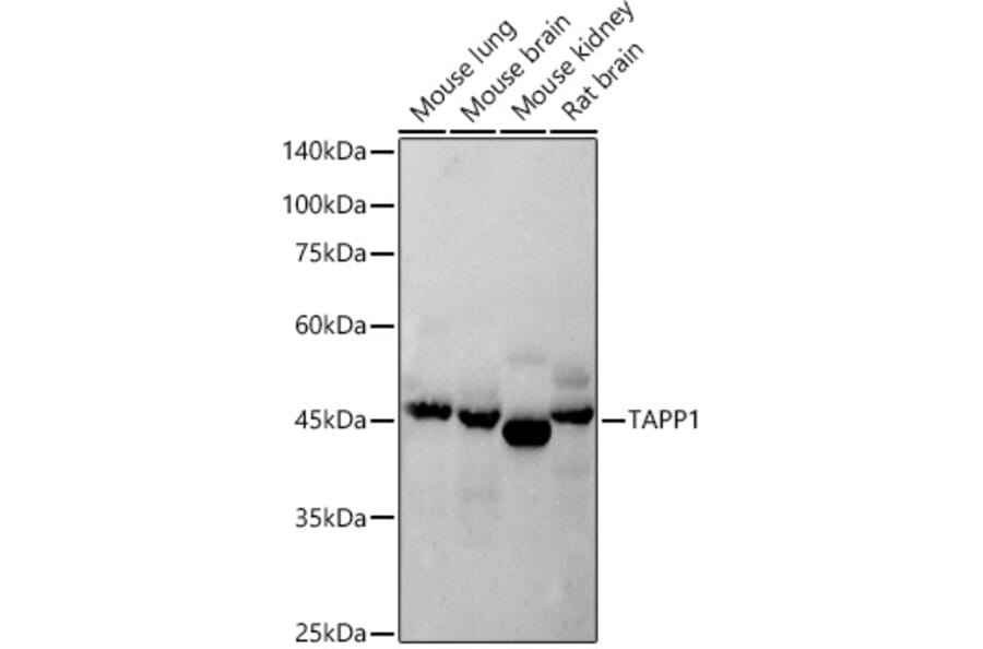 Western Blot - Anti-TAPP-1 Antibody [ARC2927] (A308627) - Antibodies.com
