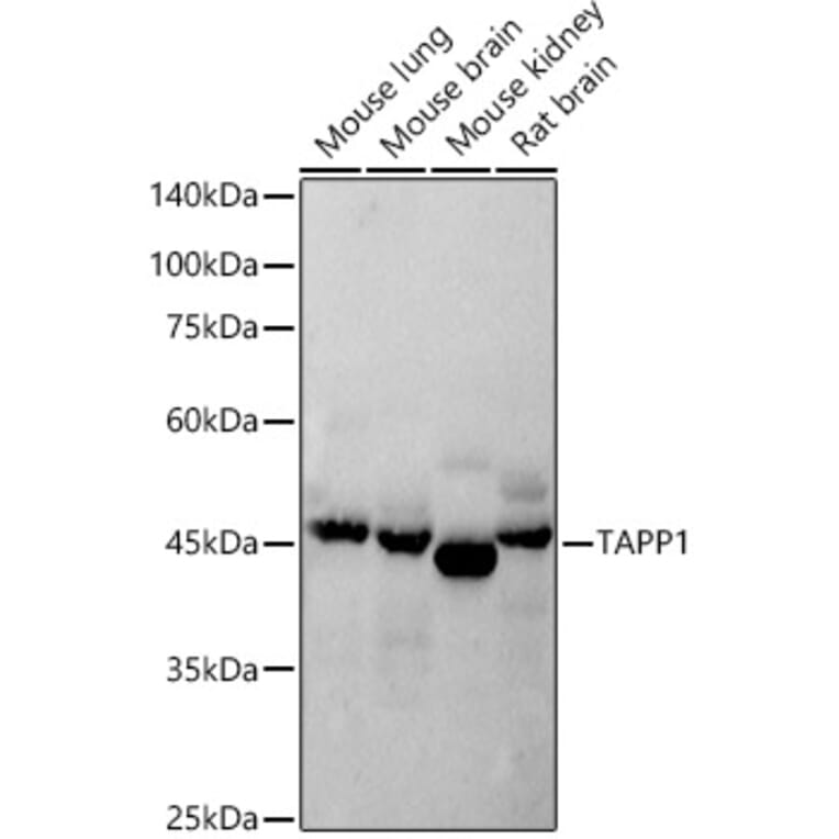 Western Blot - Anti-TAPP-1 Antibody [ARC2927] (A308627) - Antibodies.com