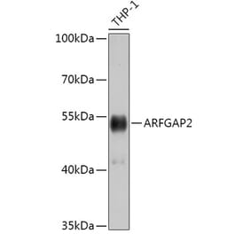 Western Blot - Anti-ARF GAP 2 Antibody (A308628) - Antibodies.com