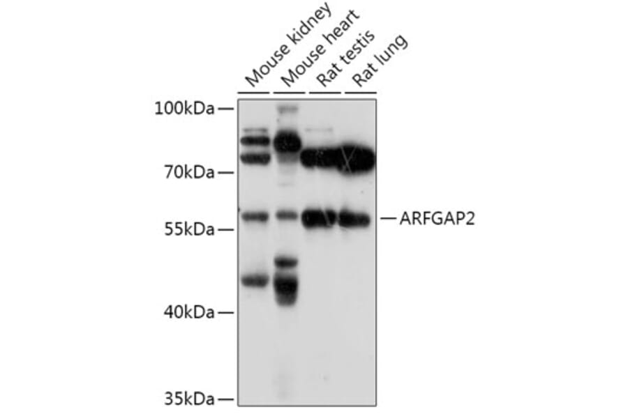 Western Blot - Anti-ARF GAP 2 Antibody (A308628) - Antibodies.com