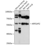 Western Blot - Anti-ARF GAP 2 Antibody (A308628) - Antibodies.com