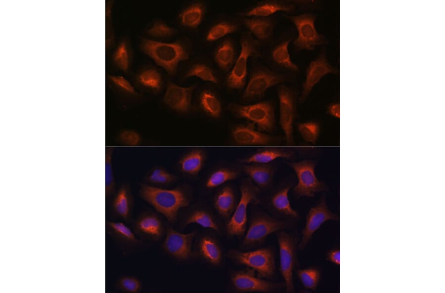 Immunofluorescence - Anti-ARF GAP 2 Antibody (A308628) - Antibodies.com