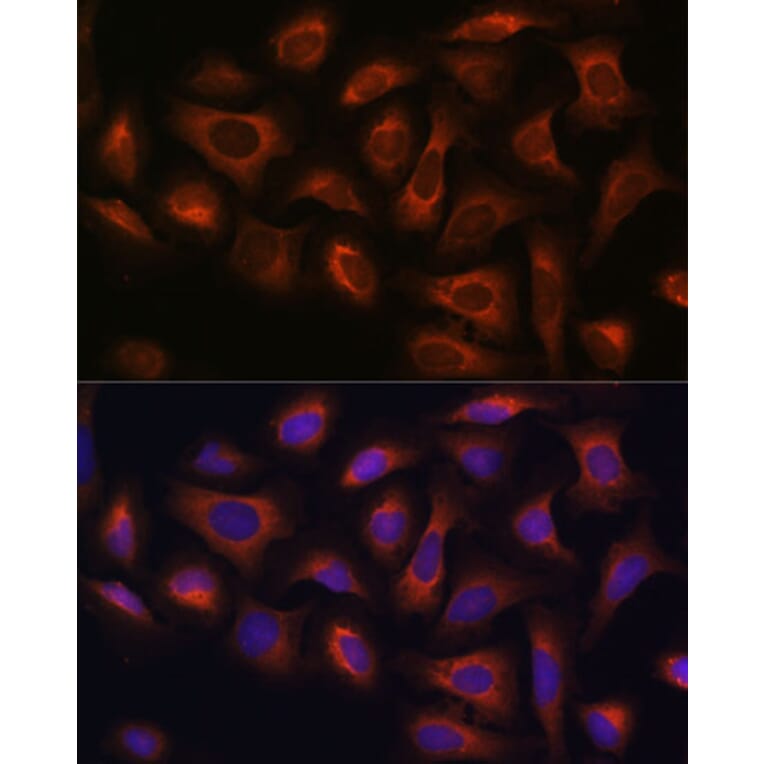 Immunofluorescence - Anti-ARF GAP 2 Antibody (A308628) - Antibodies.com