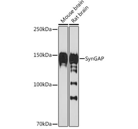 Western Blot - Anti-SynGAP Antibody [ARC2183] (A308630) - Antibodies.com