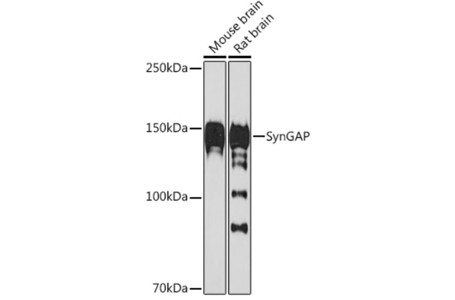Western Blot - Anti-SynGAP Antibody [ARC2183] (A308630) - Antibodies.com