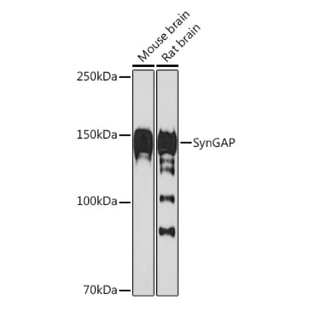 Western Blot - Anti-SynGAP Antibody [ARC2183] (A308630) - Antibodies.com