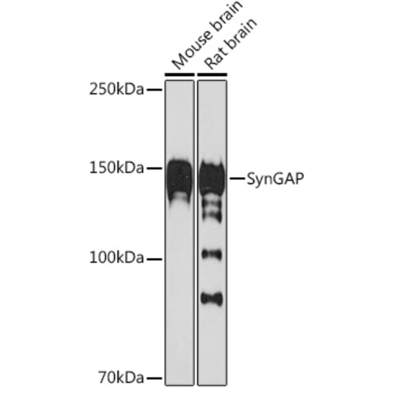 Western Blot - Anti-SynGAP Antibody [ARC2183] (A308630) - Antibodies.com