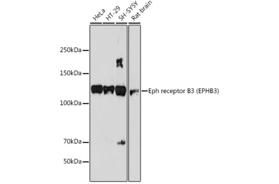 Western Blot - Anti-Eph receptor B3 Antibody [ARC2384] (A308631) - Antibodies.com