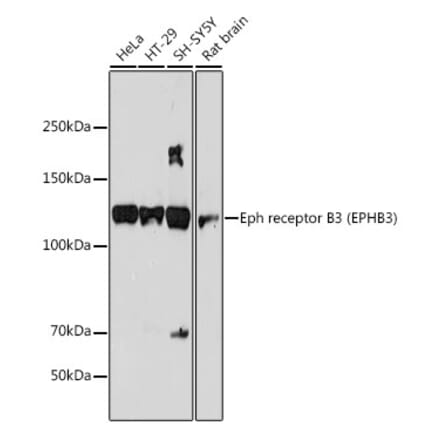 Western Blot - Anti-Eph receptor B3 Antibody [ARC2384] (A308631) - Antibodies.com