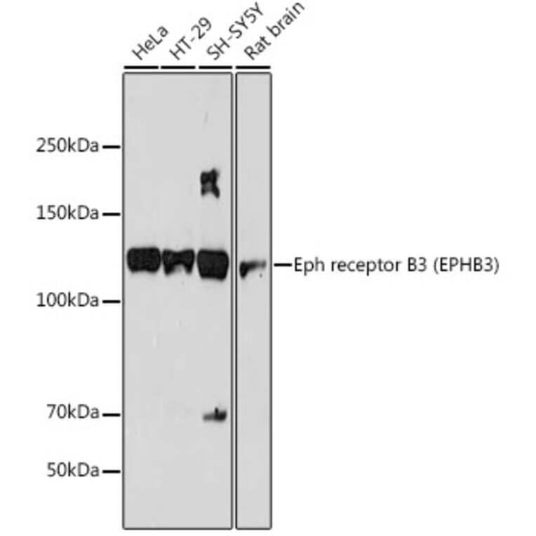 Western Blot - Anti-Eph receptor B3 Antibody [ARC2384] (A308631) - Antibodies.com