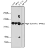 Western Blot - Anti-Eph receptor B3 Antibody [ARC2384] (A308631) - Antibodies.com