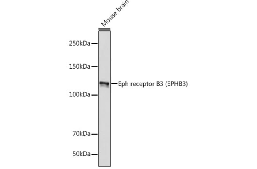 Western Blot - Anti-Eph receptor B3 Antibody [ARC2384] (A308631) - Antibodies.com
