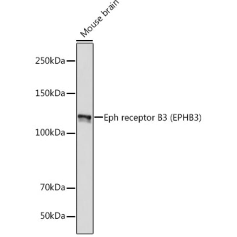 Western Blot - Anti-Eph receptor B3 Antibody [ARC2384] (A308631) - Antibodies.com