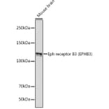 Western Blot - Anti-Eph receptor B3 Antibody [ARC2384] (A308631) - Antibodies.com