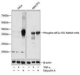 Western Blot - Anti-EIF2S1 (phospho Ser51) Antibody [ARC0130] (A308633) - Antibodies.com