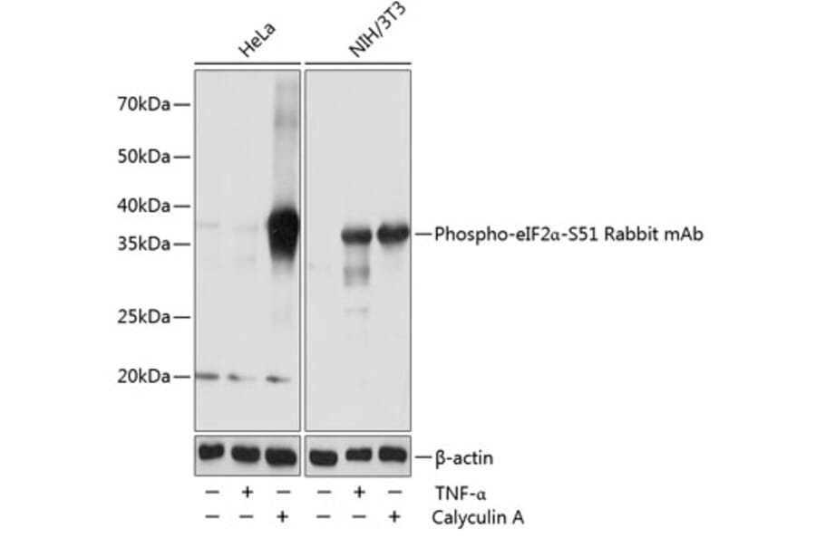 Western Blot - Anti-EIF2S1 (phospho Ser51) Antibody [ARC0130] (A308633) - Antibodies.com