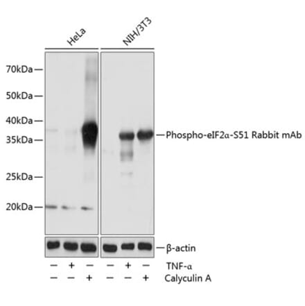 Western Blot - Anti-EIF2S1 (phospho Ser51) Antibody [ARC0130] (A308633) - Antibodies.com