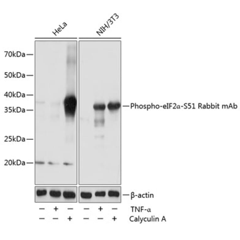 Western Blot - Anti-EIF2S1 (phospho Ser51) Antibody [ARC0130] (A308633) - Antibodies.com