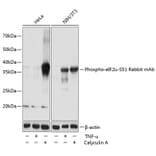 Western Blot - Anti-EIF2S1 (phospho Ser51) Antibody [ARC0130] (A308633) - Antibodies.com