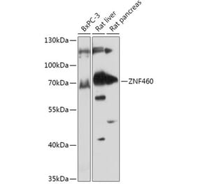 Western Blot - Anti-ZNF460 Antibody (A308634) - Antibodies.com