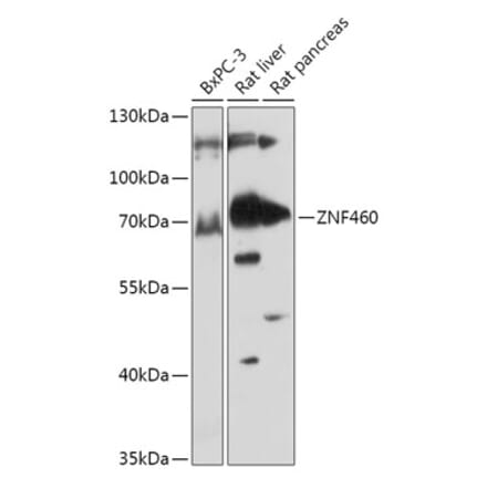 Western Blot - Anti-ZNF460 Antibody (A308634) - Antibodies.com