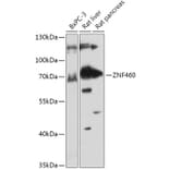 Western Blot - Anti-ZNF460 Antibody (A308634) - Antibodies.com