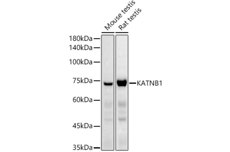 Western Blot - Anti-KATNB1 Antibody (A308635) - Antibodies.com