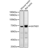 Western Blot - Anti-KATNB1 Antibody (A308635) - Antibodies.com