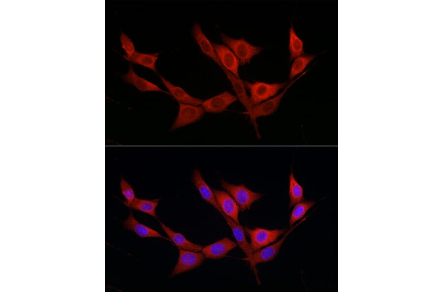Immunofluorescence - Anti-KATNB1 Antibody (A308635) - Antibodies.com