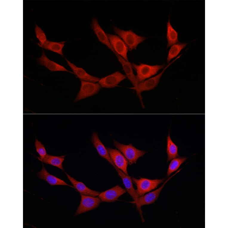 Immunofluorescence - Anti-KATNB1 Antibody (A308635) - Antibodies.com