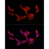 Immunofluorescence - Anti-KATNB1 Antibody (A308635) - Antibodies.com