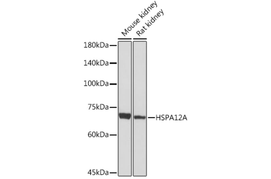 Western Blot - Anti-HSPA12A Antibody [ARC2351] (A308636) - Antibodies.com