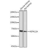 Western Blot - Anti-HSPA12A Antibody [ARC2351] (A308636) - Antibodies.com