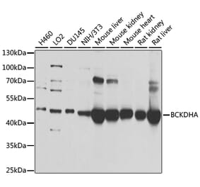 Western Blot - Anti-BCKDHA Antibody (A308637) - Antibodies.com