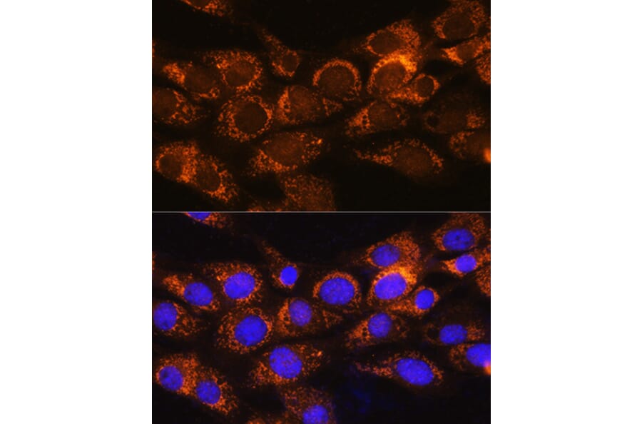 Immunofluorescence - Anti-BCKDHA Antibody (A308637) - Antibodies.com