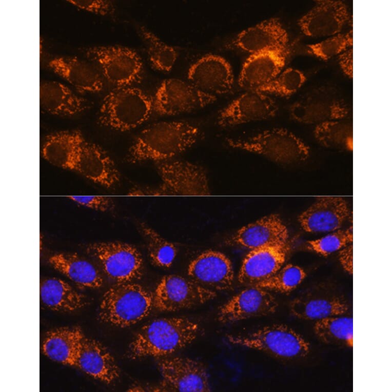 Immunofluorescence - Anti-BCKDHA Antibody (A308637) - Antibodies.com