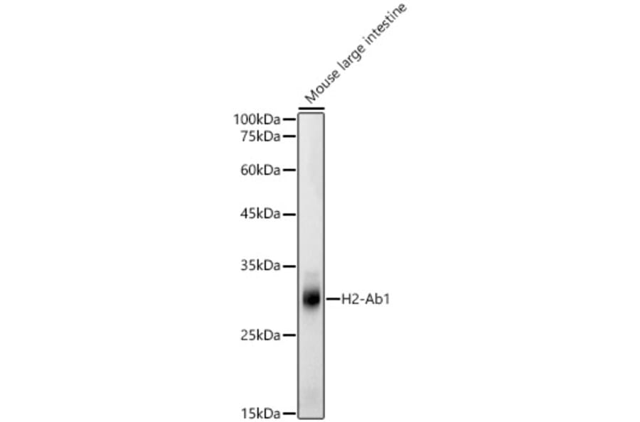 Western Blot - Anti-H2-Ab1 Antibody (A308638) - Antibodies.com