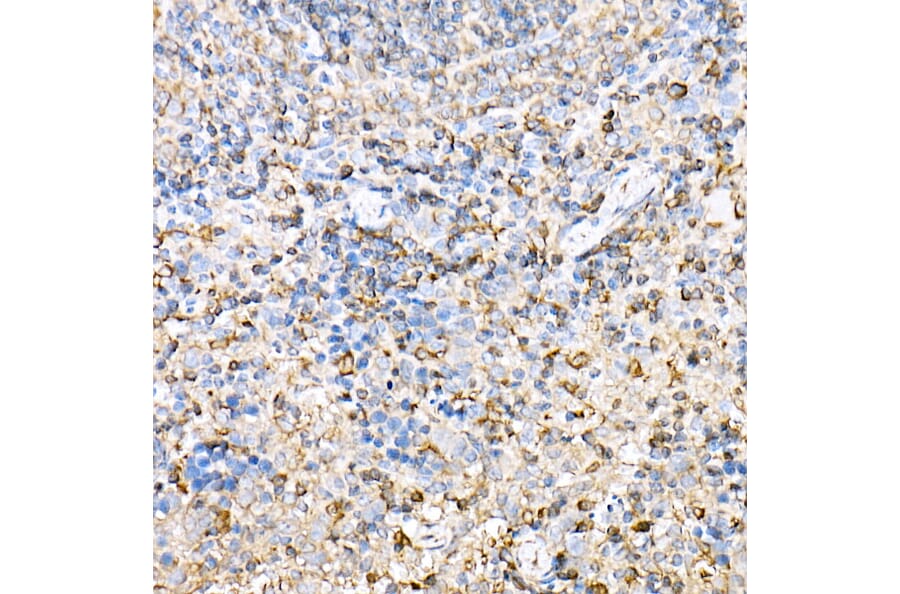 Immunohistochemistry - Anti-H2-Ab1 Antibody (A308638) - Antibodies.com