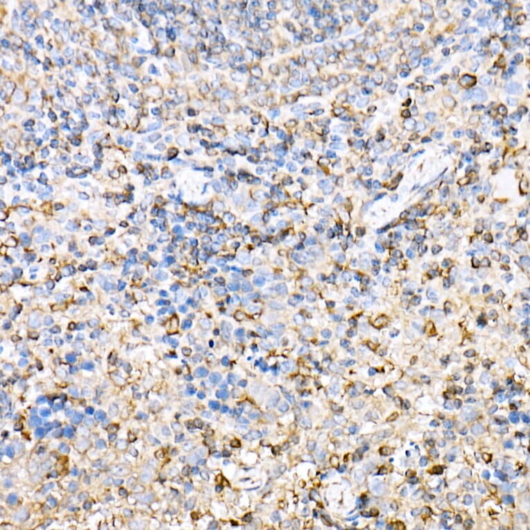 Immunohistochemistry - Anti-H2-Ab1 Antibody (A308638) - Antibodies.com