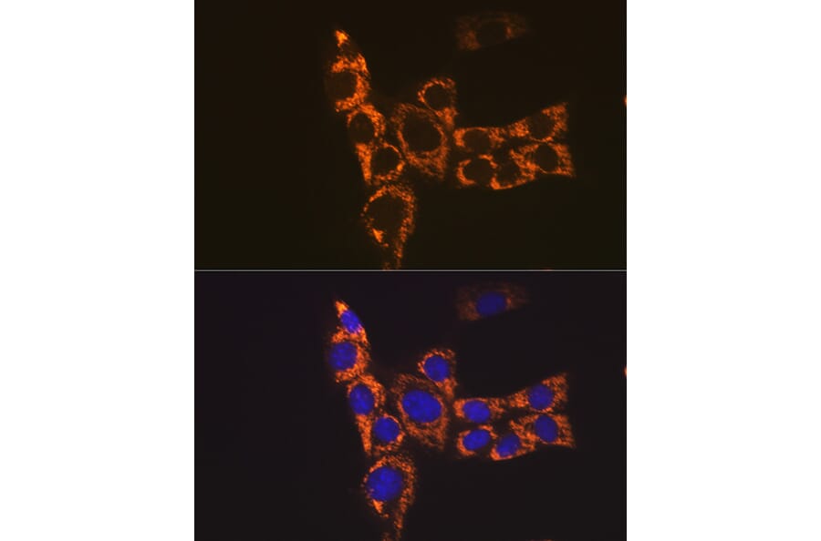 Immunofluorescence - Anti-H2-Ab1 Antibody (A308638) - Antibodies.com